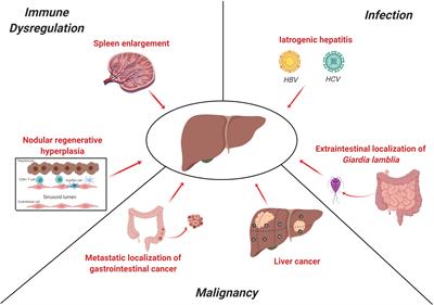 Heterogeneity of Liver Disease in Common Variable Immunodeficiency Disorders